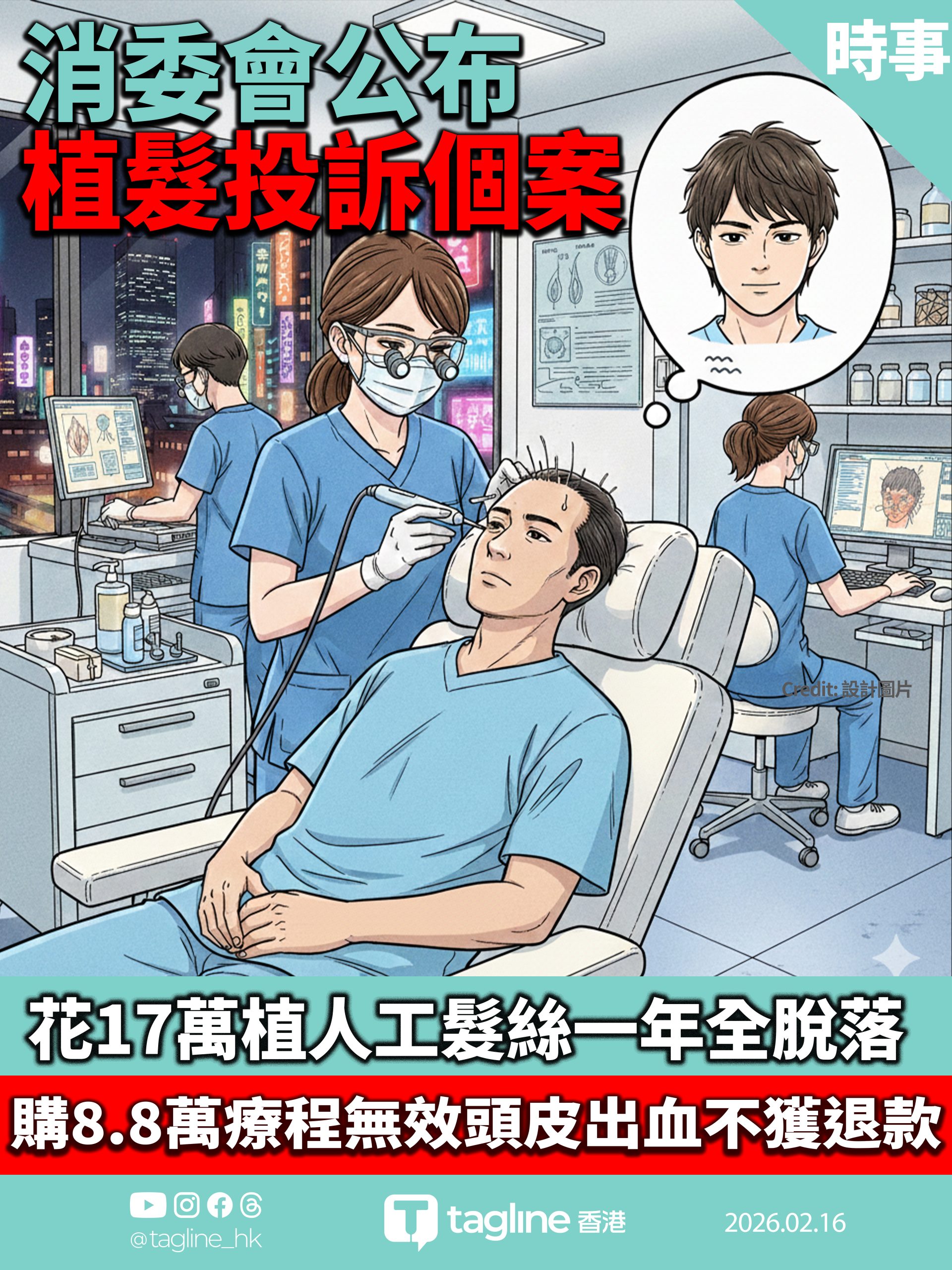 【Sagami安全套特約】消委會公布植髮投訴個案 花17萬植人工髮絲一年全脫落 市民購8.8萬療程無效頭皮出血不獲退款