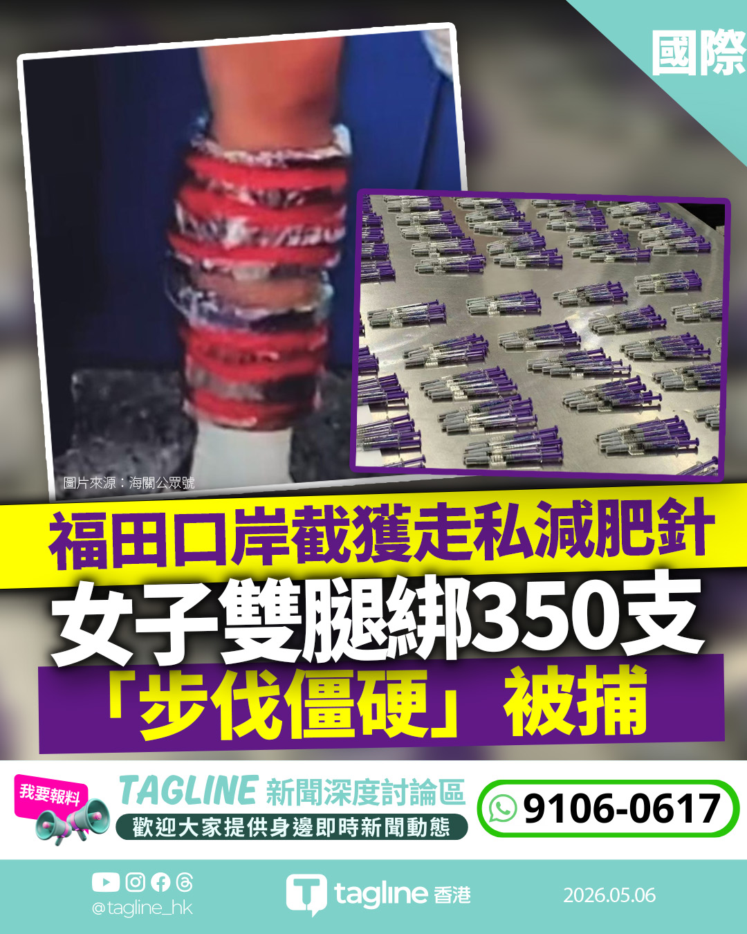福田口岸截獲走私減肥針 女子雙腿綁350支「步伐僵硬」被捕