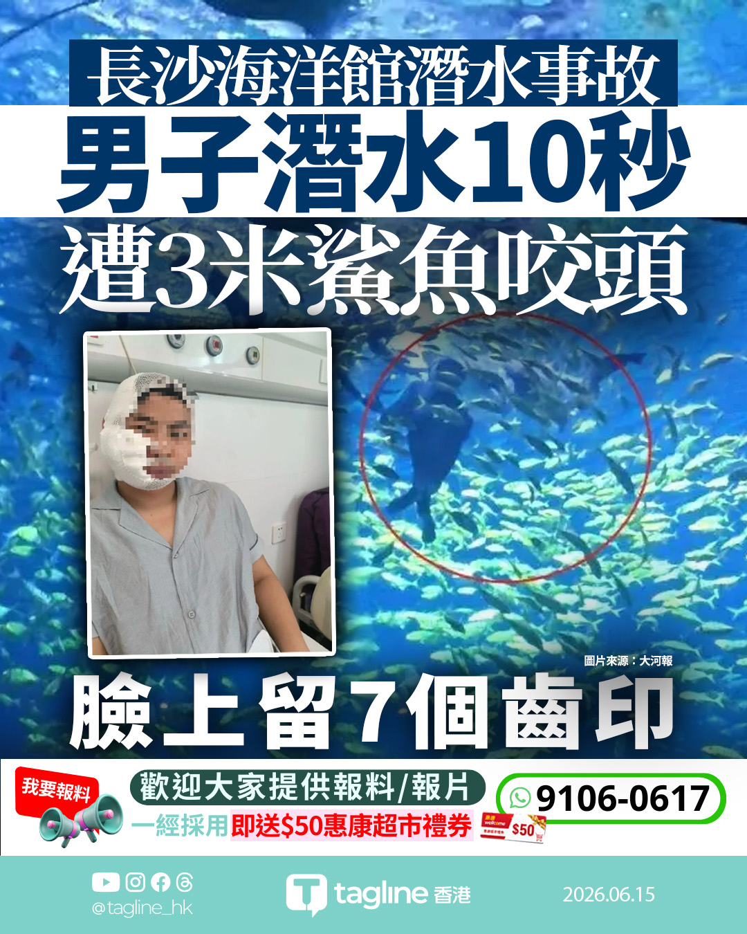 長沙海洋王國潛水意外 3米沙虎鯊咬傷遊客頭部